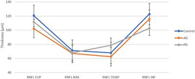 Neurophthalmologic and Orthoptic Ambulatory Assessments Reveal Ocular and Visual Changes in Patients With Early Alzheimer and Parkinson's Disease